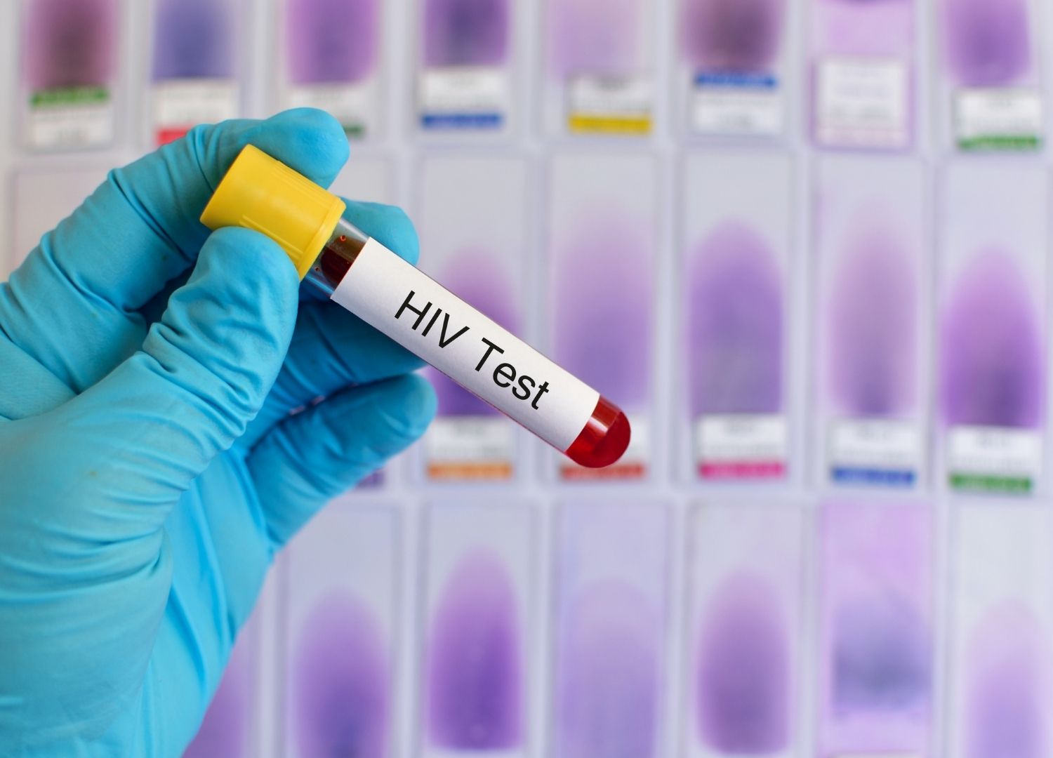 Myths and Facts about HIV