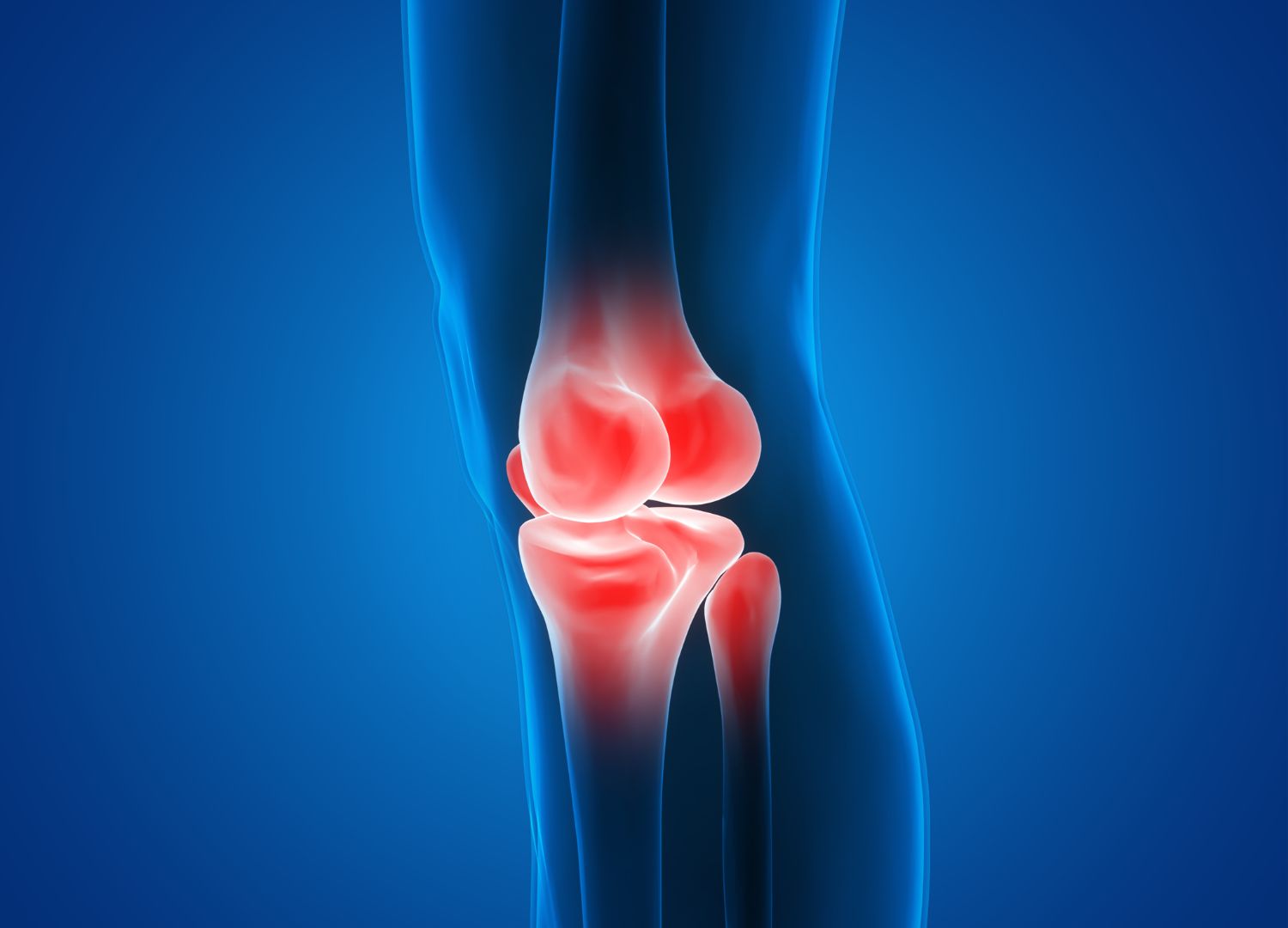 Osteomyelitis (Bone Infection): What you should know