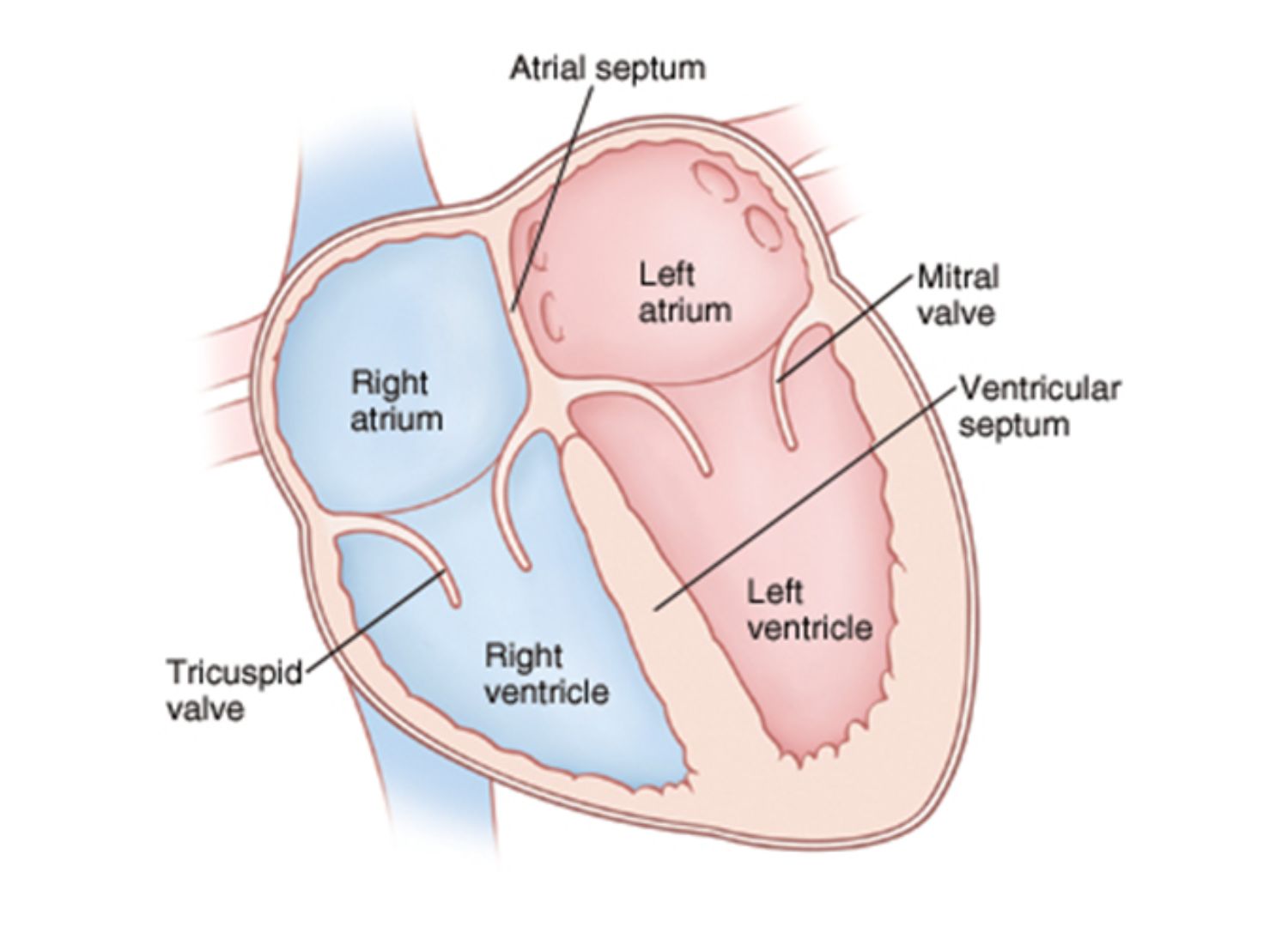 Septal defects: A hole in the heart