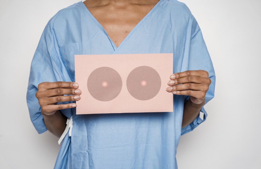 Breast cancer: 5 Important Things to Know