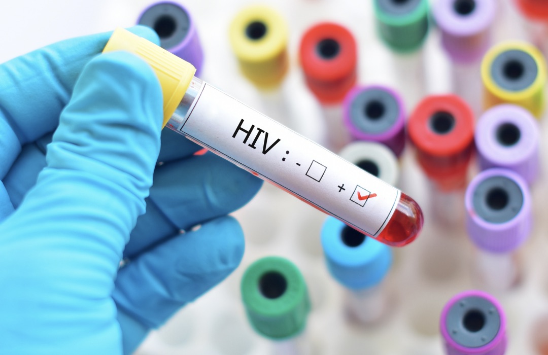 How do I know I have HIV?