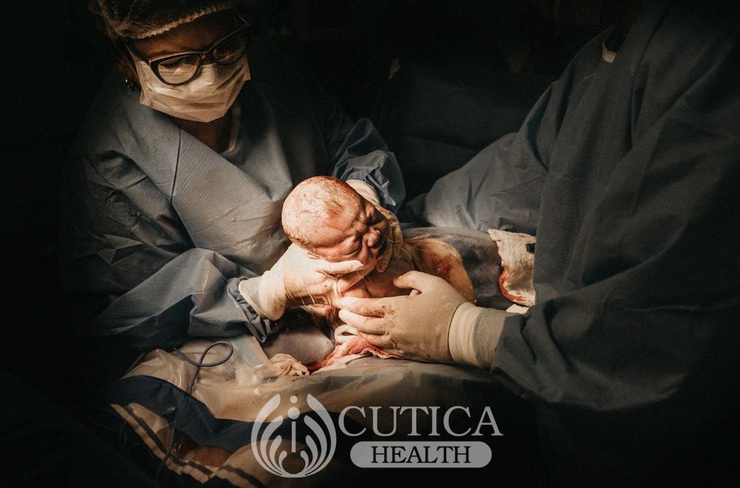 Vaginal Birth After Cesarean section