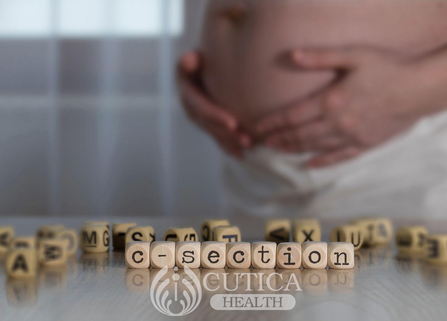 Cesarean Section: Why Must I Have It?