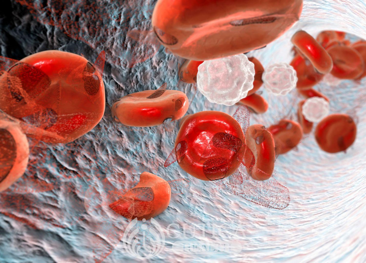 Anemia: Causes and Treatment