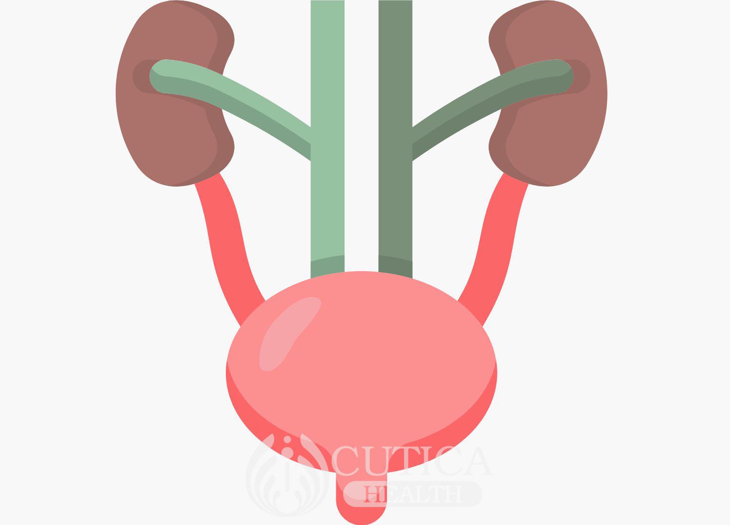 Urinary Tract Obstruction