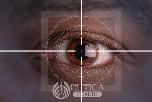 Exercise May Lower Your Risk of Cataract , A Leading Cause of Blindness