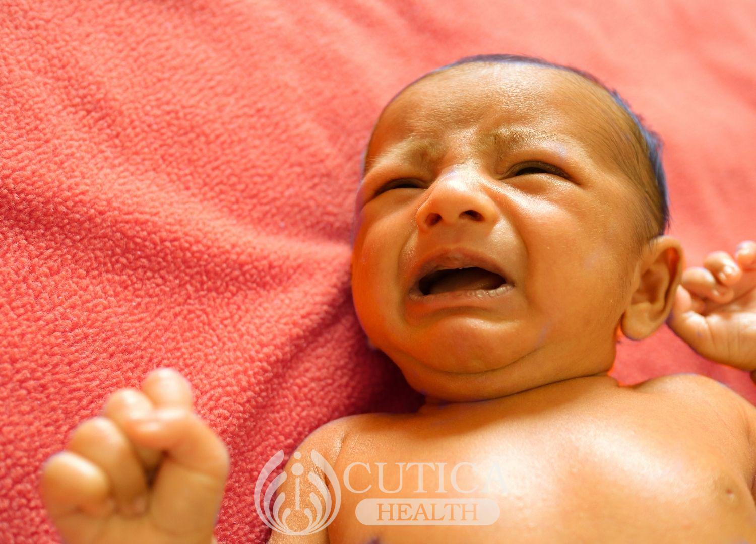 Jaundice in a newborn