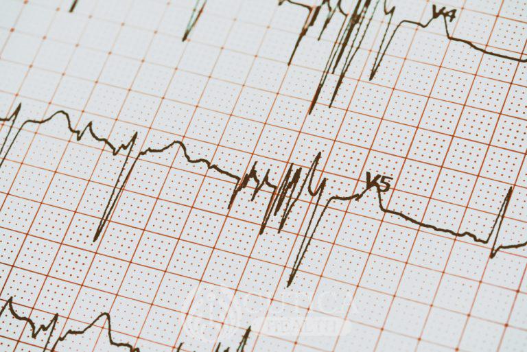 Australia Study Shows Reduction of Heart Attack and Stroke Risk in Diabetics is Possible.