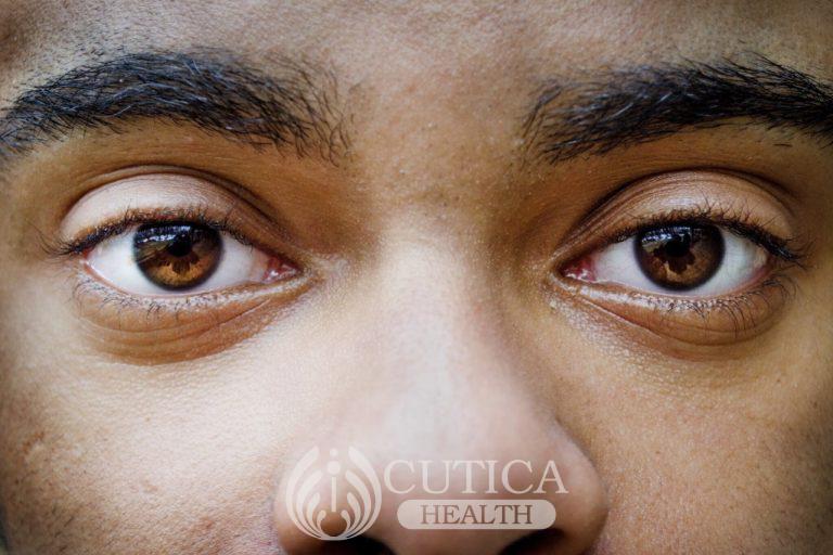 Overcoming Glaucoma, A Silent Cause of Blindness