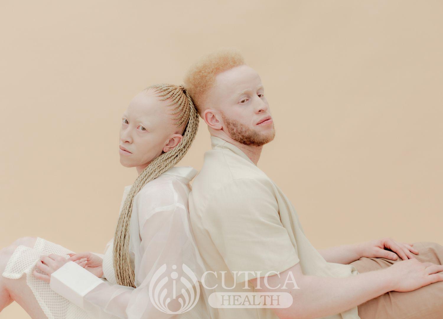 Celebrating Albinism