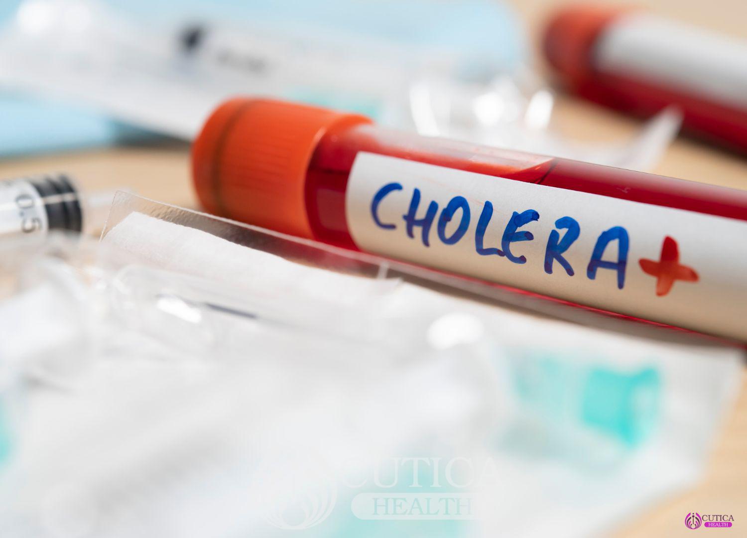 Understanding Cholera Outbreaks