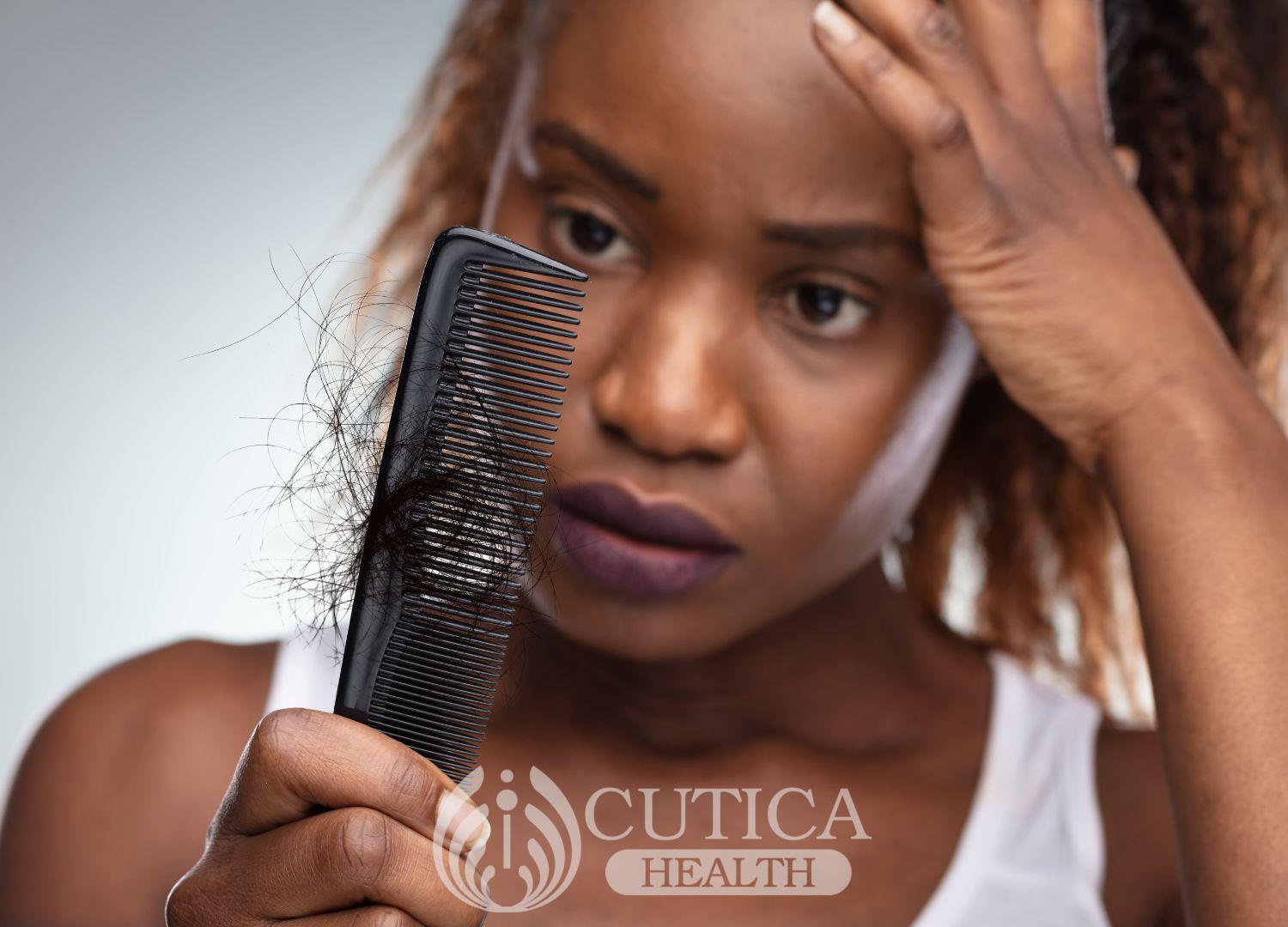 Hair loss in women: A woman's hair is her crown and glory (Pidgin)