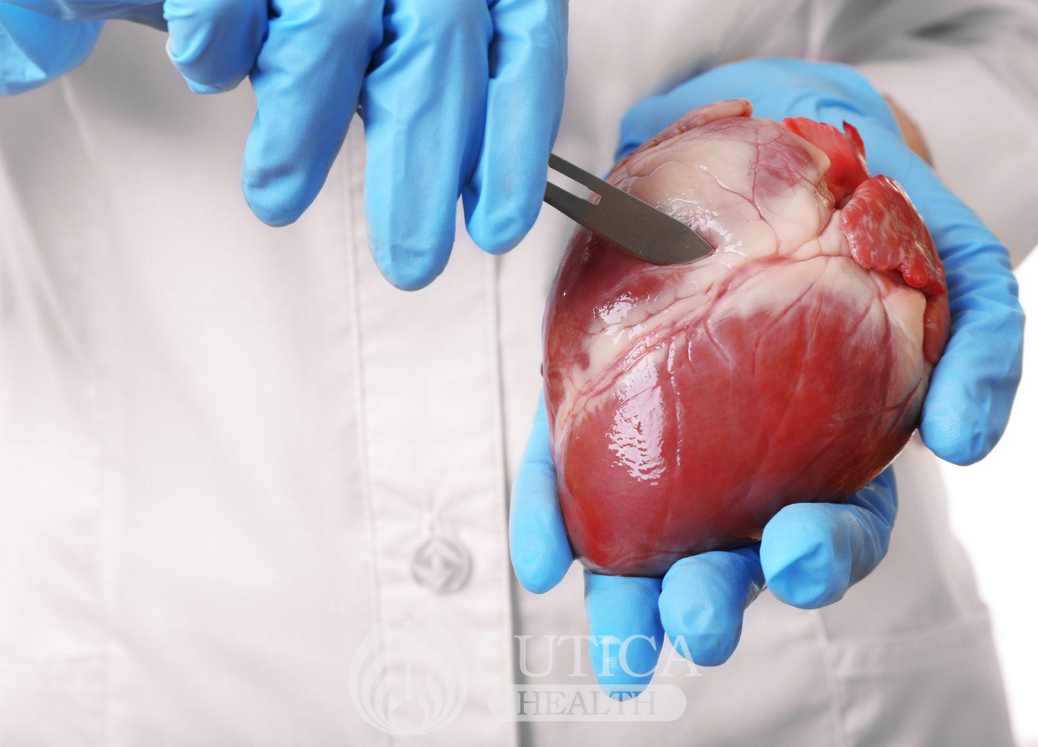 Heart Transplant: Wetin you suppose sabi about am