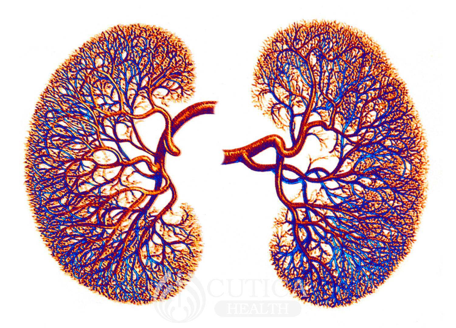 Increased Rates of Kidney Failure in Nigeria