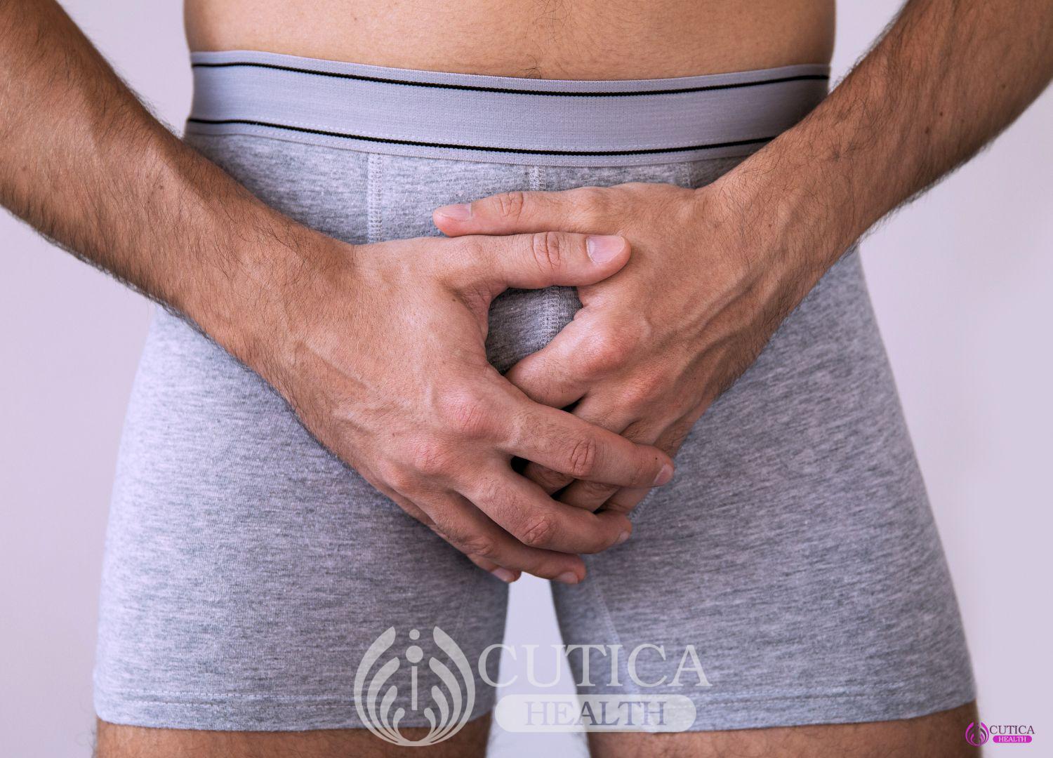 Understanding Penile Discharge: Causes, Symptoms, and Treatments