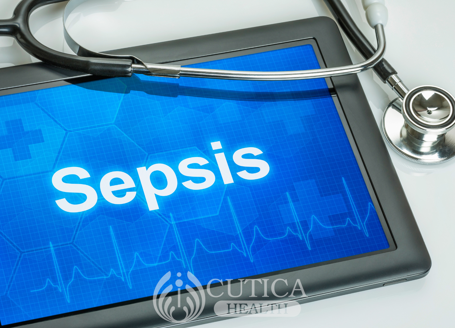 Reducing Sepsis Fatalities in Critically Ill Patients