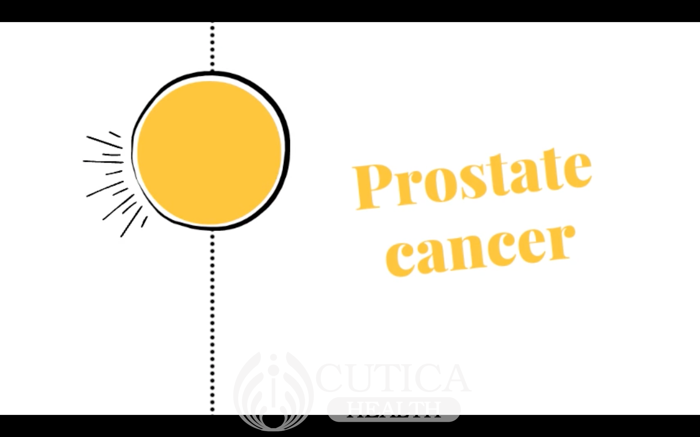 Prostate Cancer: What to Know