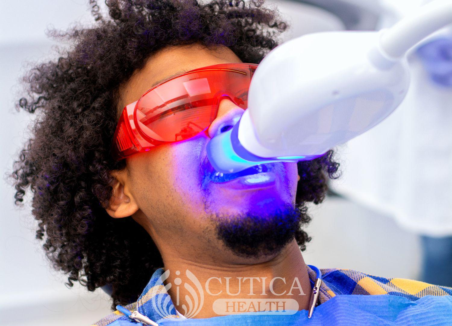 7 Things you should know about teeth whitening.