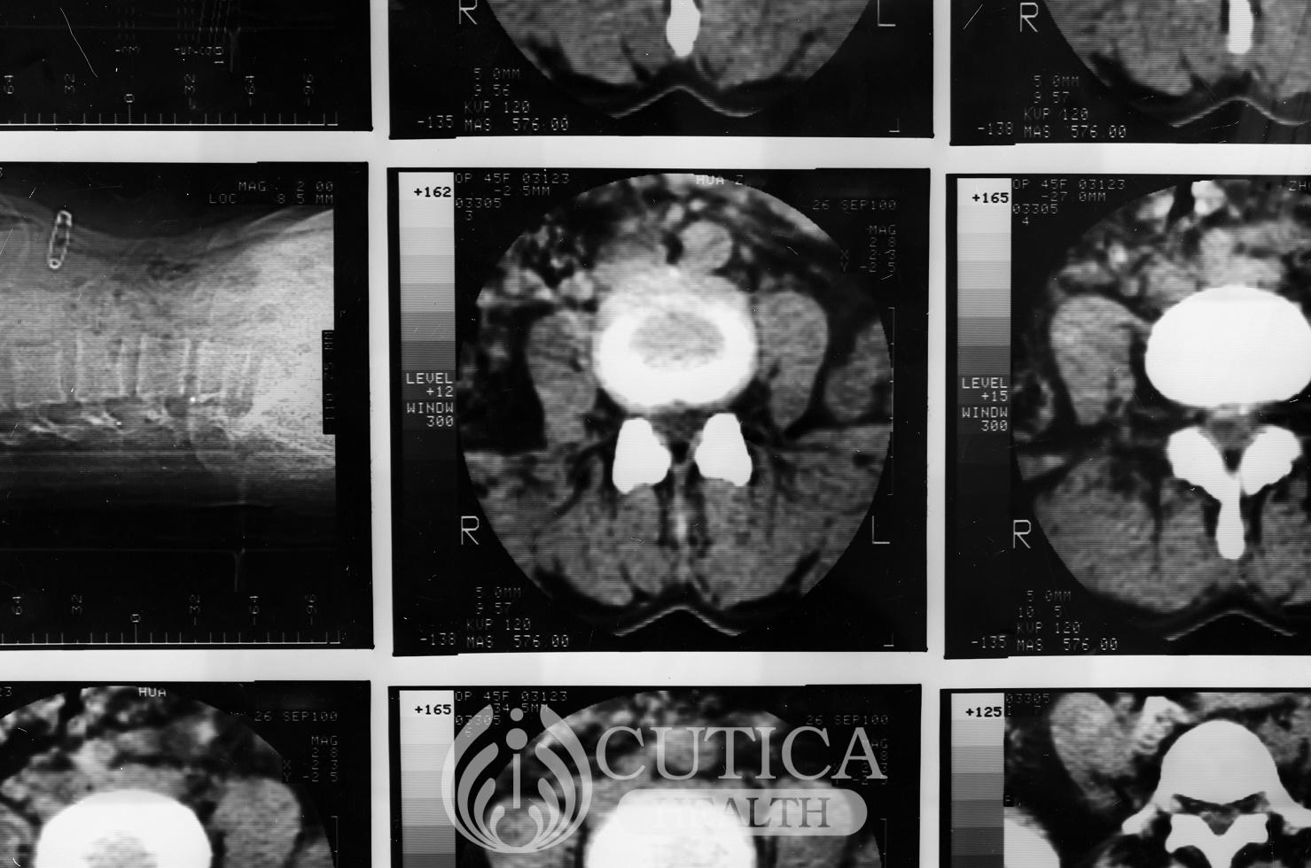 Researchers create a transparent skull to examine the brain of mice