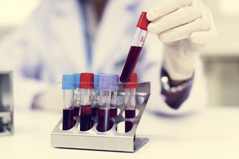 doctor-checking-blood-samples-PVSC328-768x513