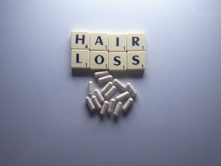 hair-loss-4591561_1280-768x576