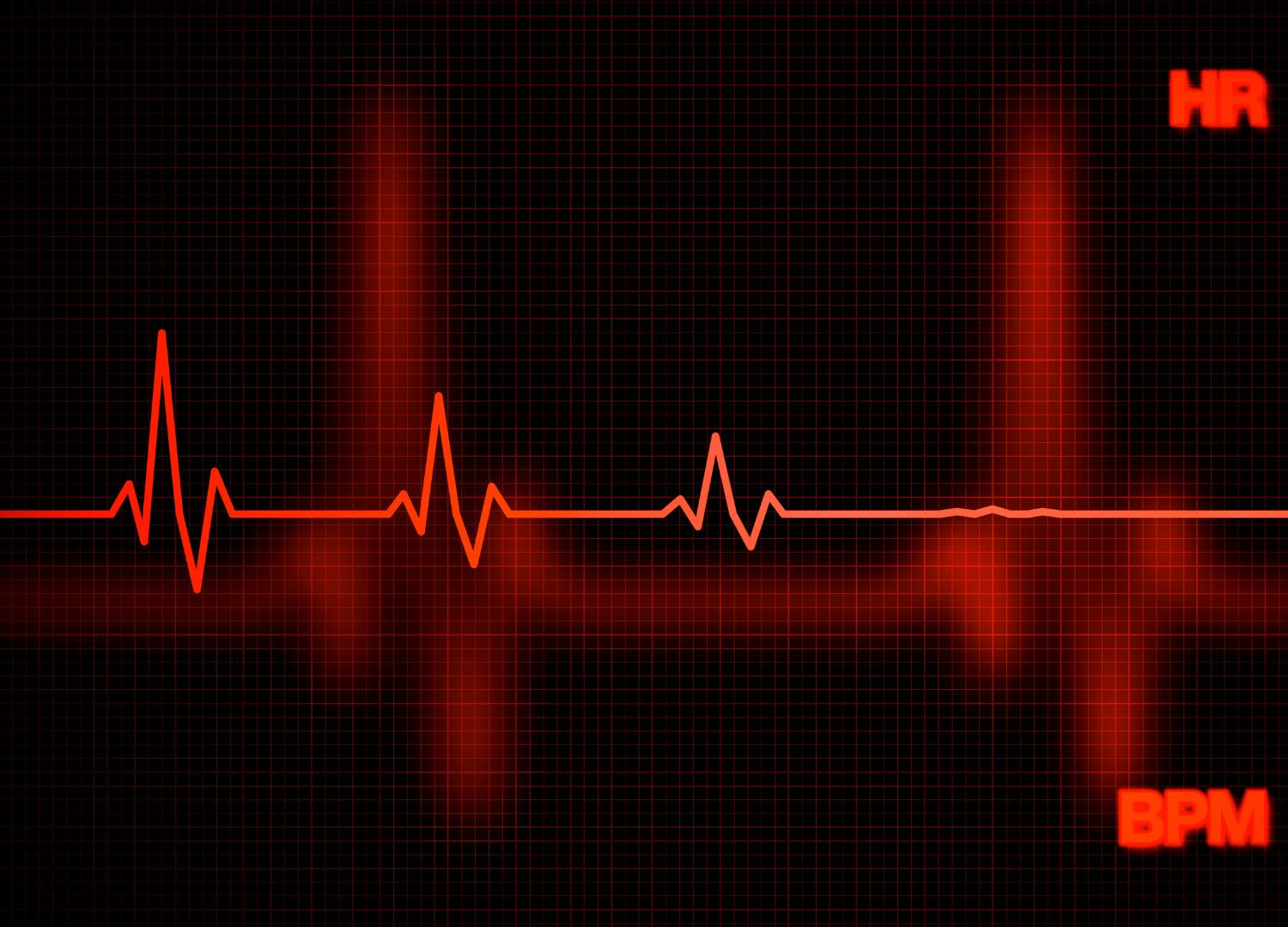 Heart Failure: Signs Your Heart May be Failing