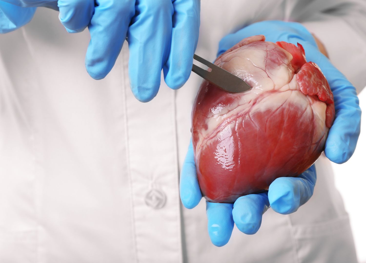 Heart Transplant: Wetin you suppose sabi about am