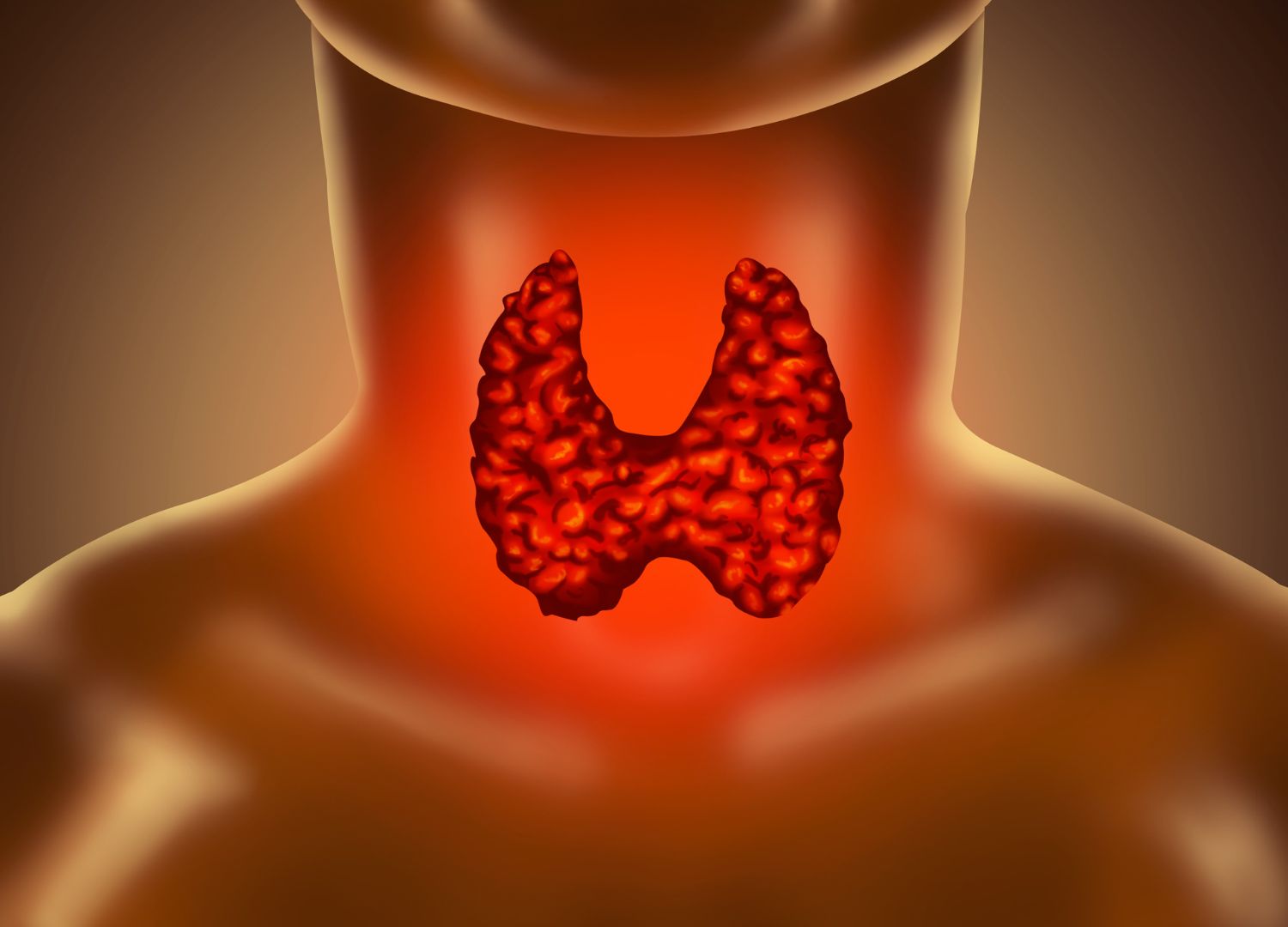 Hypothyroidism: Underactive thyroid function