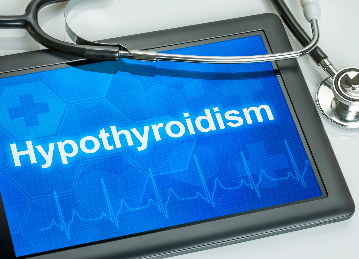 "Hypothyroidism: Underactive thyroid  function (Pidgin)"