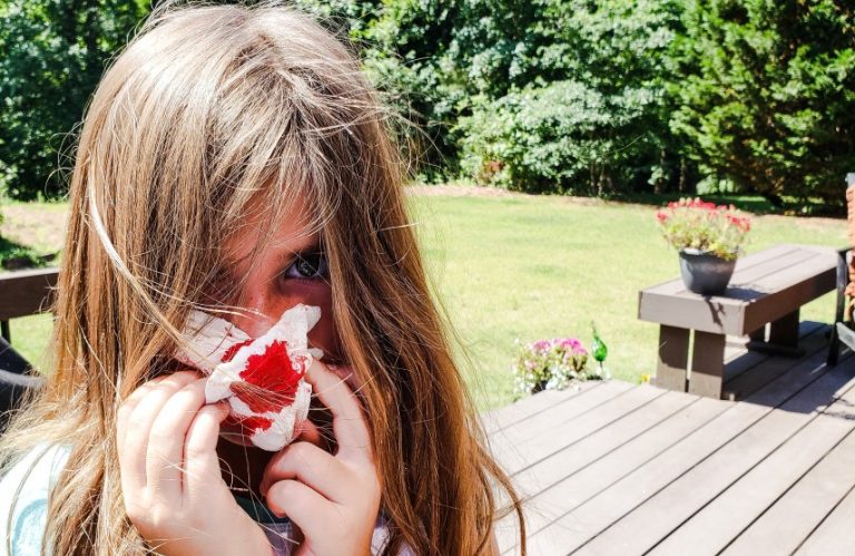 Reasons why your child may nosebleed, and what to do about it
