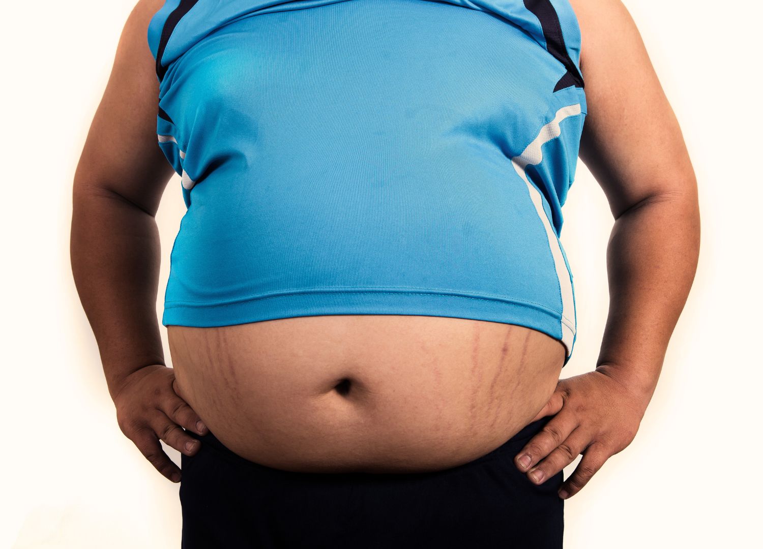 Pot Belly: Causes, Health Risks, and Effective Solutions