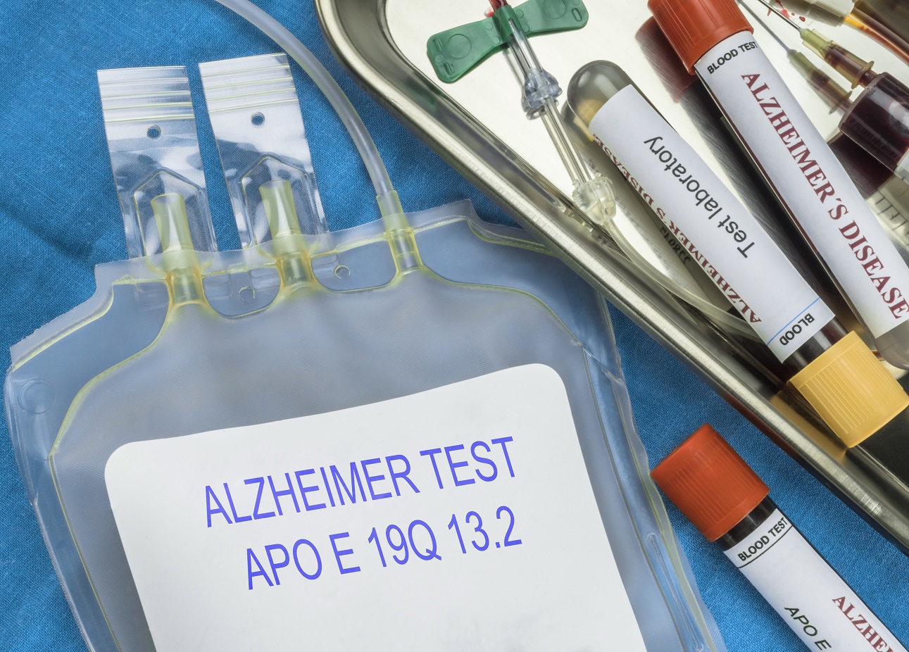 A potential way to treat Alzheimer’s disease discovered