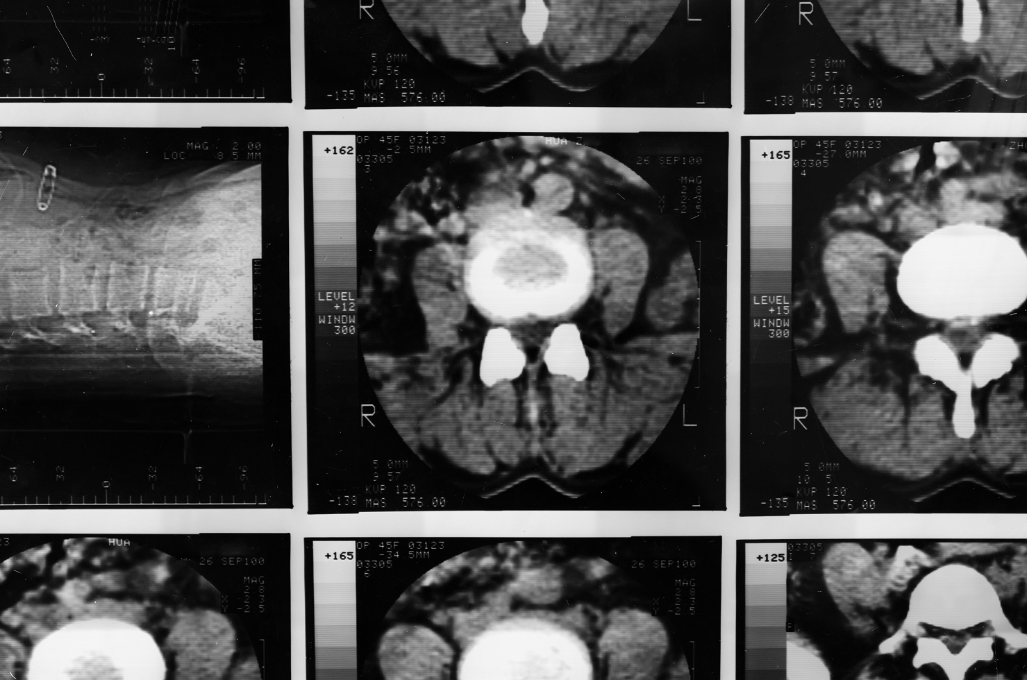 Researchers create a transparent skull to examine the brain of mice